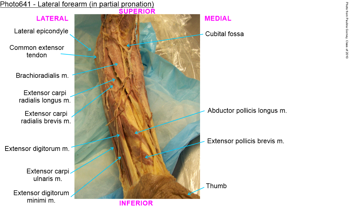 SG-UPPER LIMB FOREARM POSTERIOR, image size:1153x685
