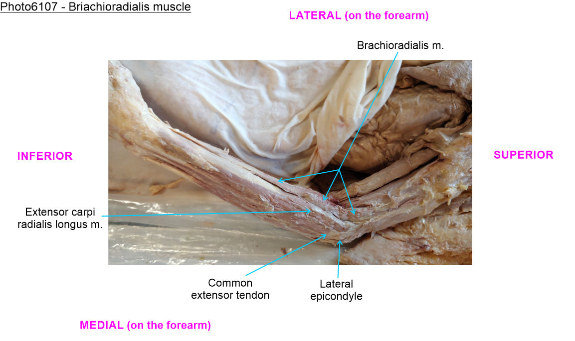 Lab 19: Muscles of the Anterior Forearm | The Hand – Human Anatomy Lab  Manual, image size:1153x685